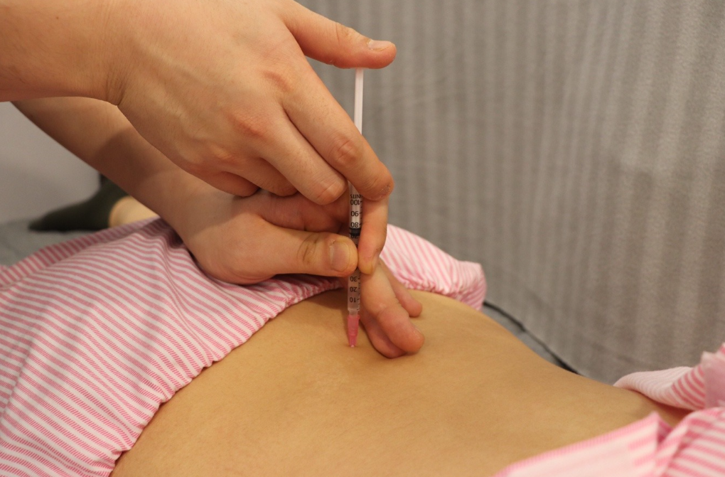 High-concentration Bee Venom and Pharmacopuncture therapy at Body-all Clinic Suwon